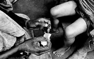 Mutilazione Genitale Femminile,MGF, uno scempio che deve finire